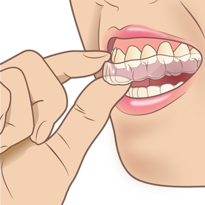 歯ぎしりを軽減する意外な方法